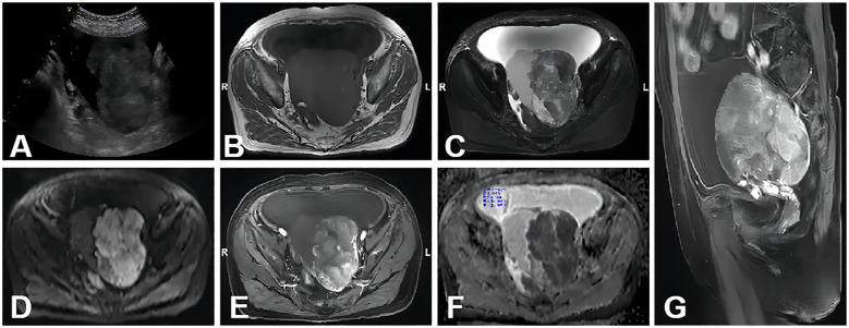 Figure 3