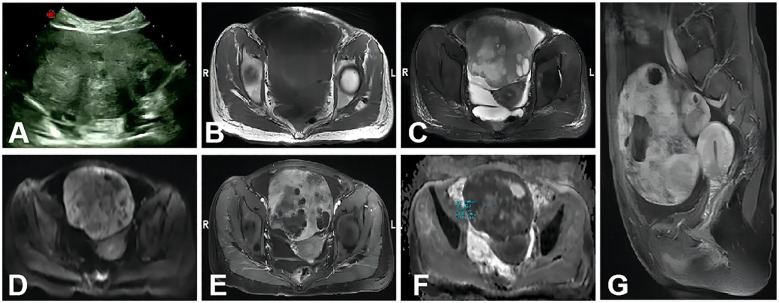 Figure 4