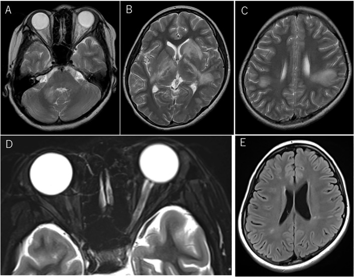 Figure 2