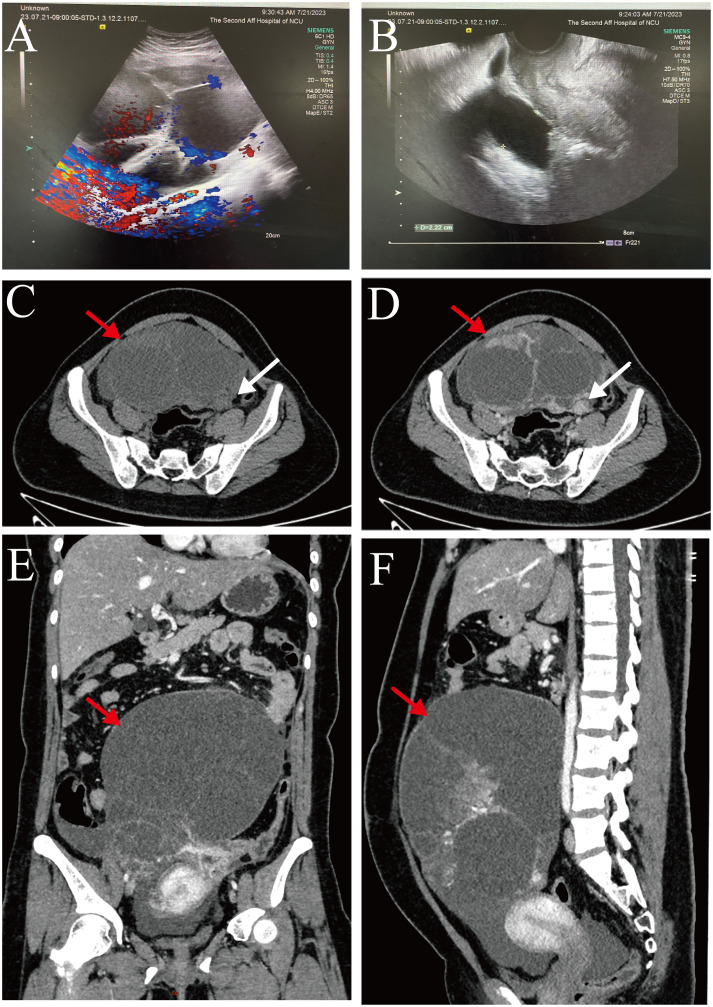 Figure 1
