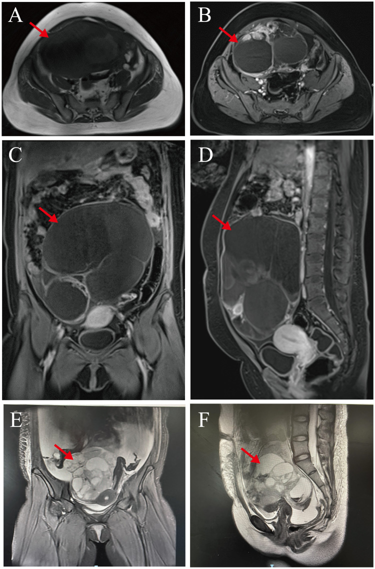 Figure 2