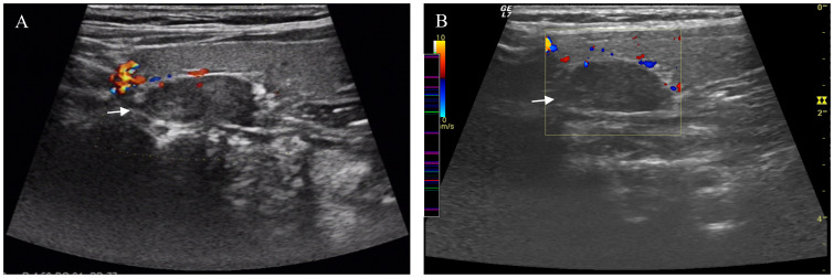 Figure 1