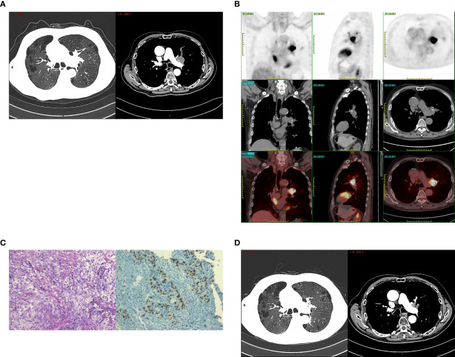 Figure 1