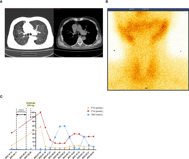 Figure 2