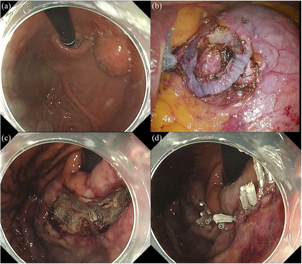 FIGURE 3