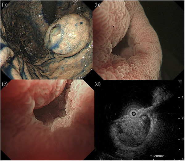 FIGURE 2