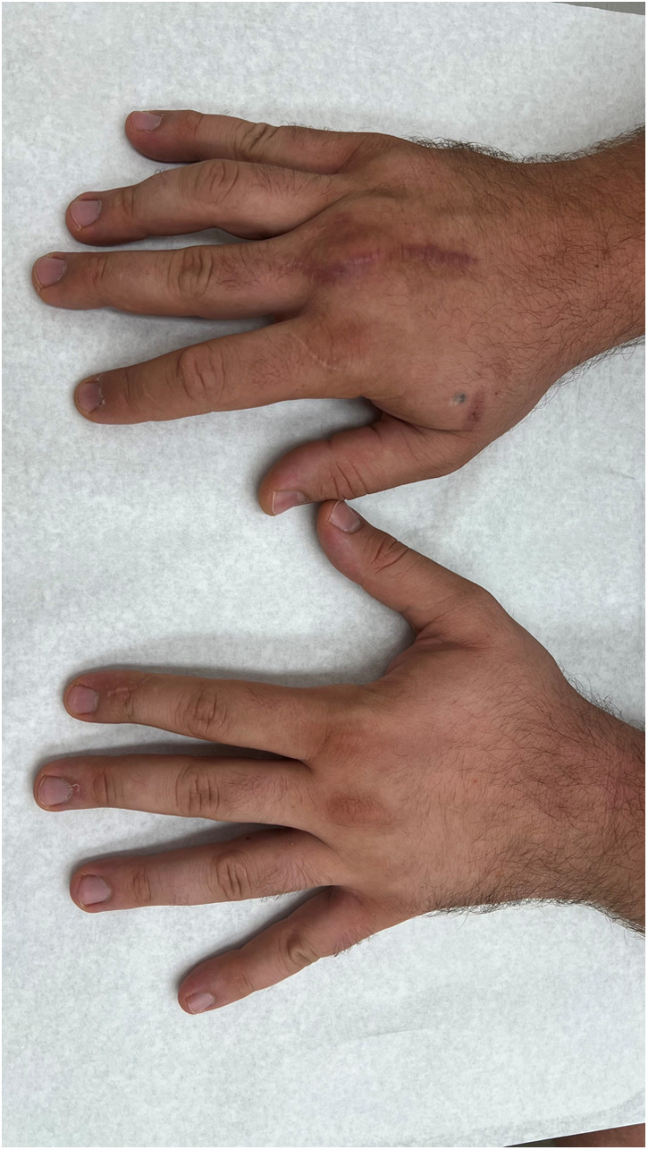 Figure 12