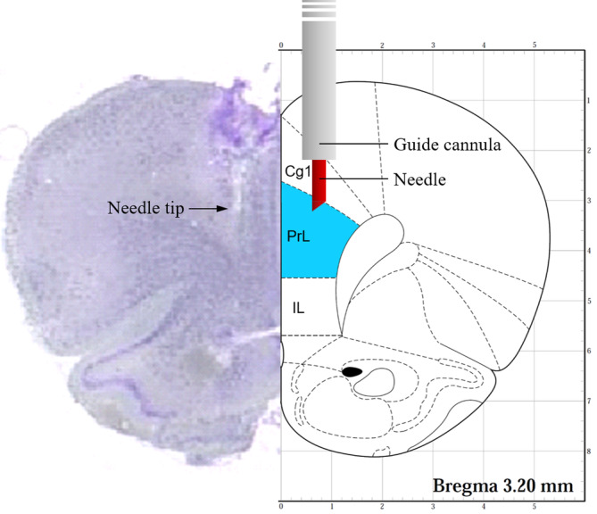 FIGURE 3