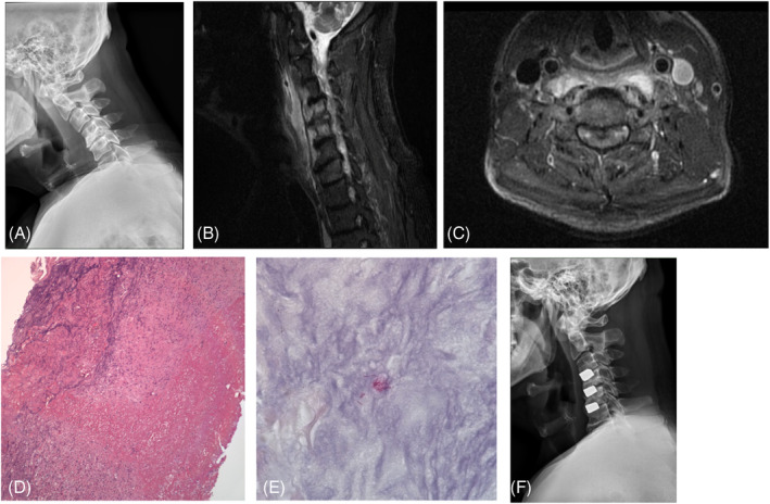 FIGURE 1