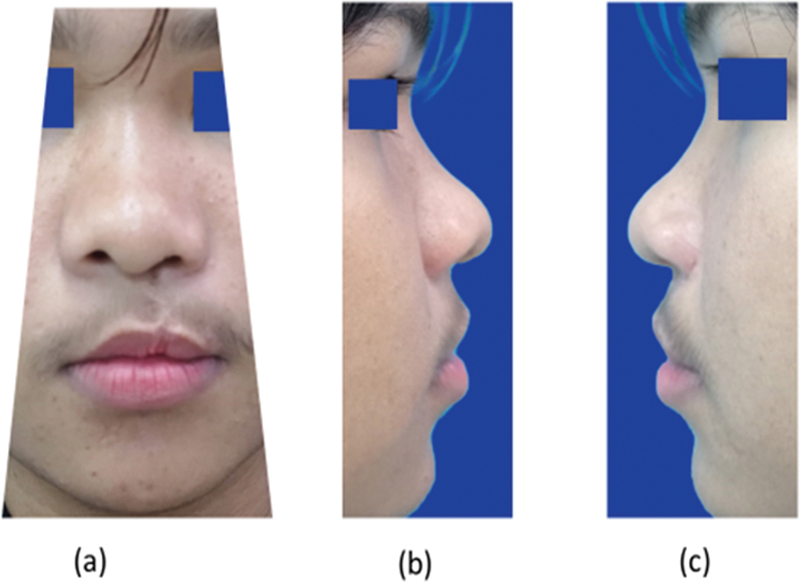 Fig. 2