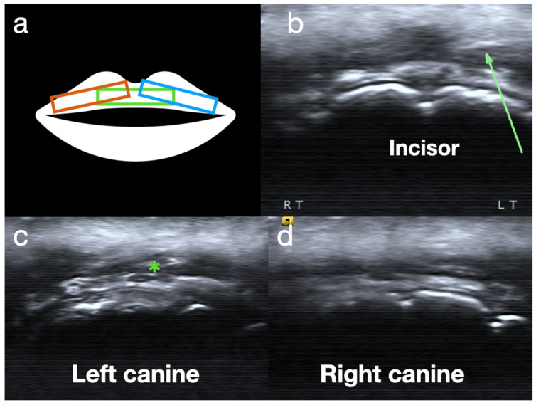 Figure 4