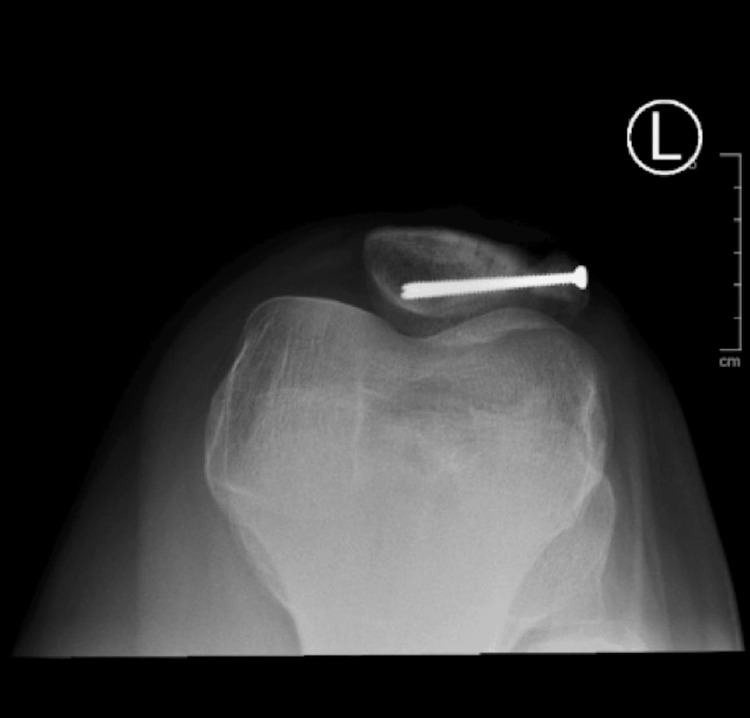 Figure 9