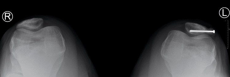 Figure 11