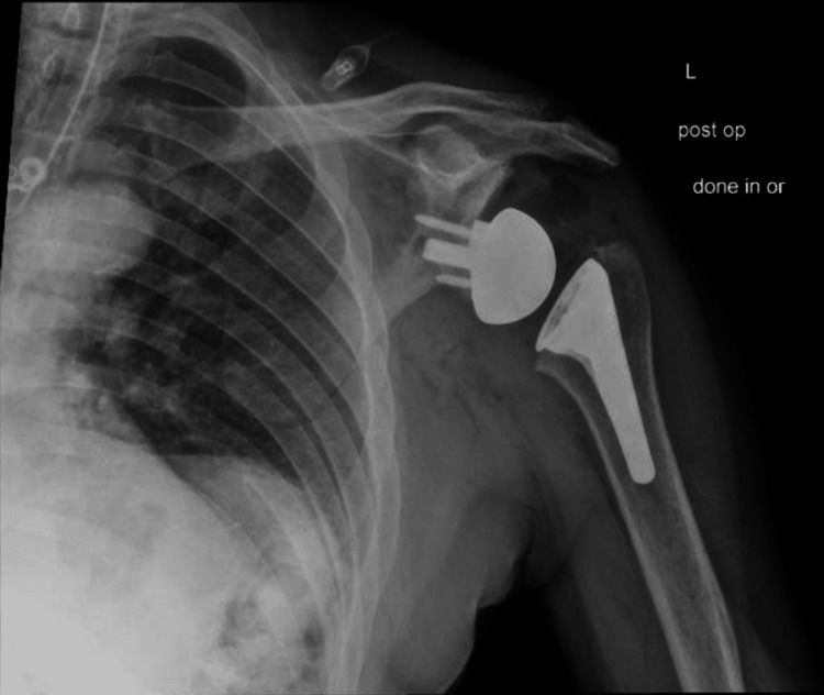 Figure 13