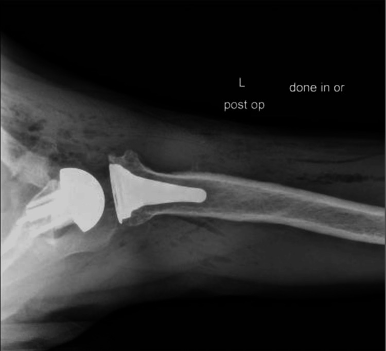 Figure 14