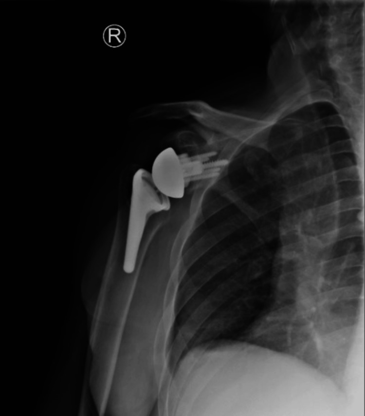 Figure 15