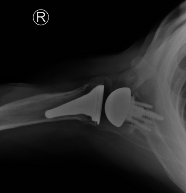 Figure 16