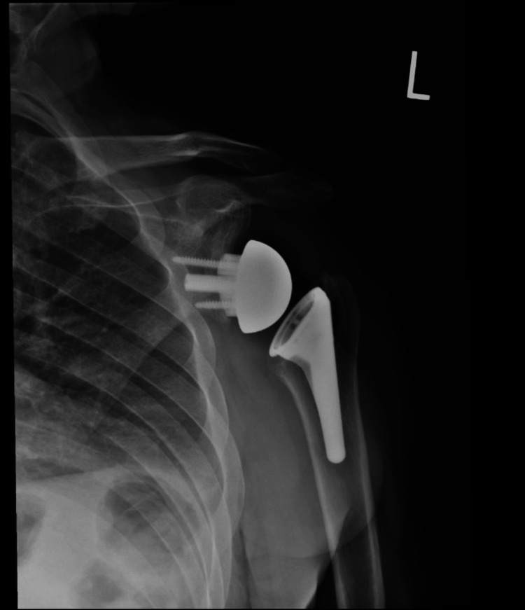 Figure 17