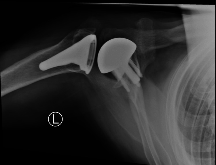 Figure 18