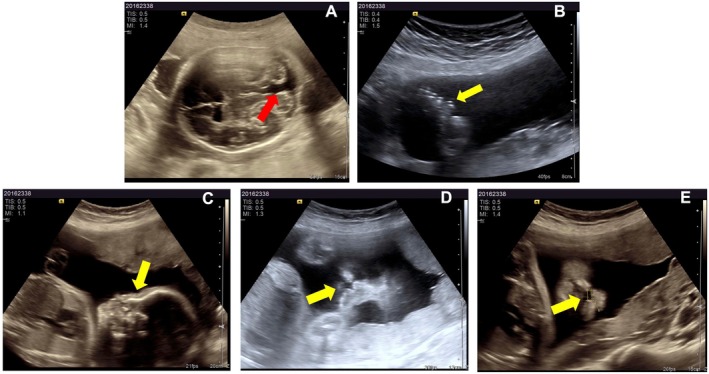 Figure 5