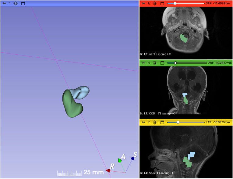 Figure 2
