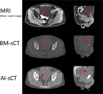 FIGURE 3