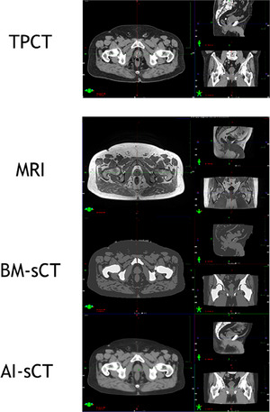 FIGURE 2