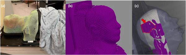 FIGURE 2