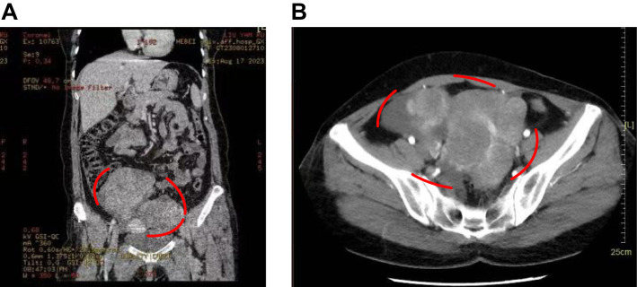 Figure 1