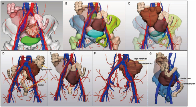 Figure 2