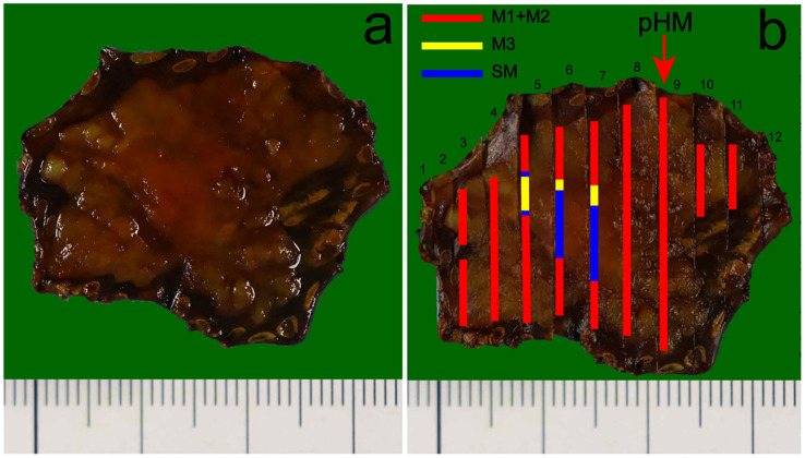 Figure 4