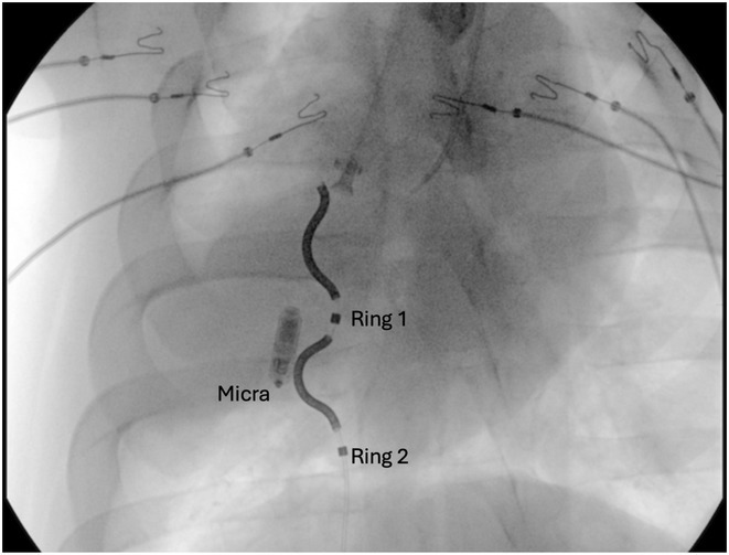 Figure 12
