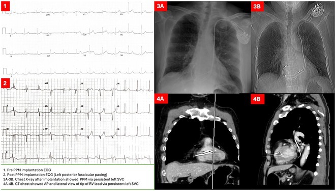 Figure 20