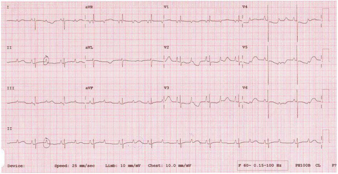 Figure 23