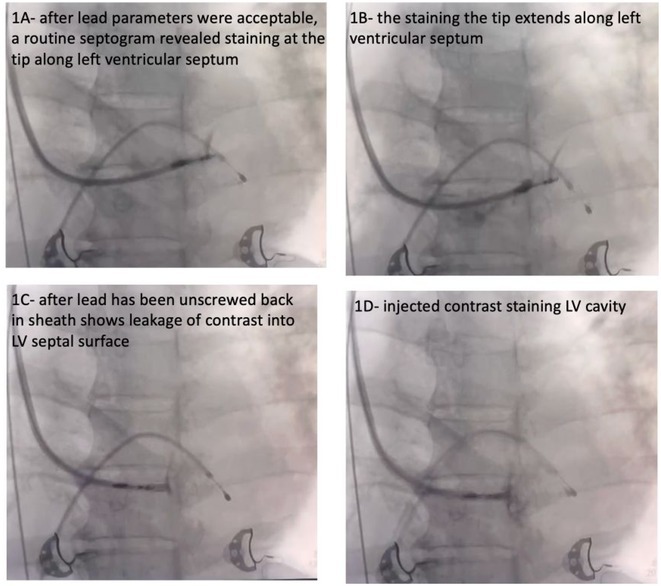 Figure 32