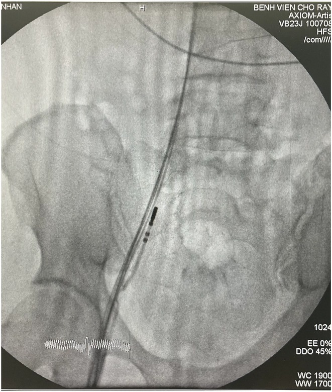 Figure 39