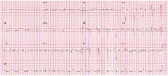 Figure 41