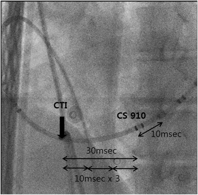 Figure 43