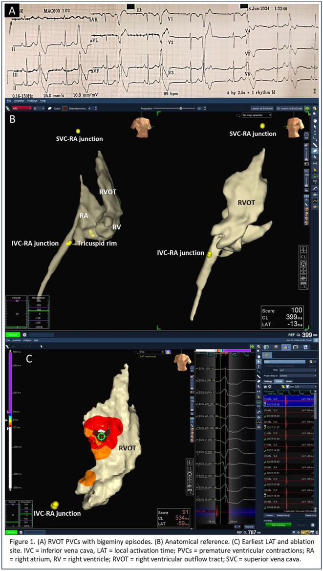 Figure 47