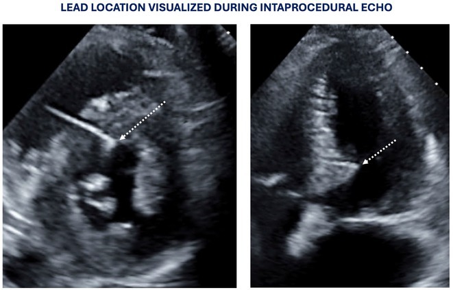 Figure 25