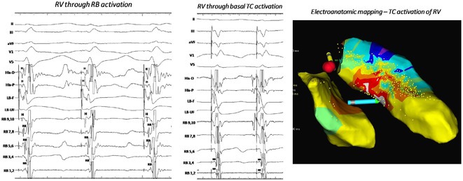 Figure 30