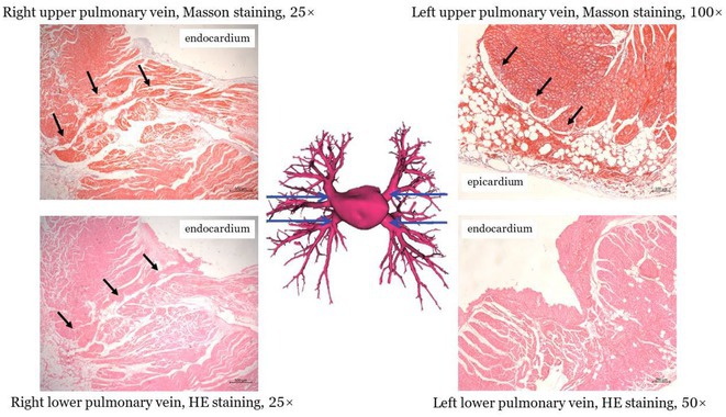 Figure 32