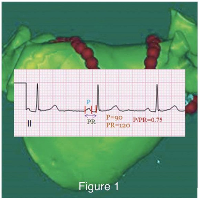 Figure 48