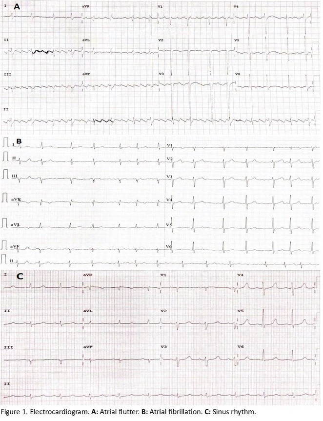 Figure 13