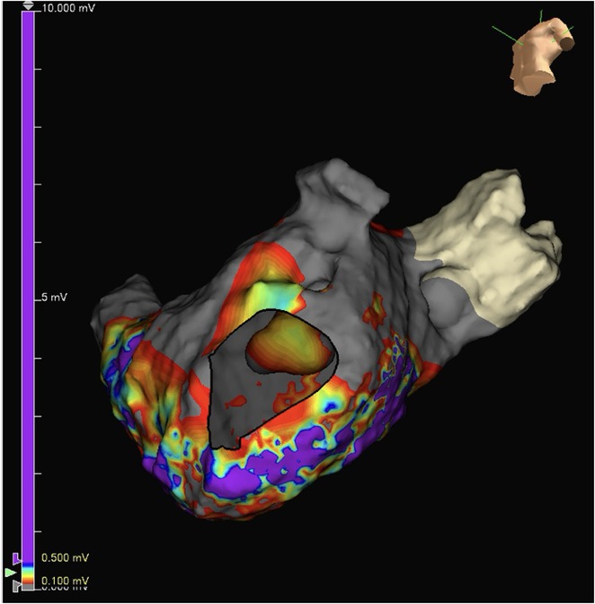 Figure 16