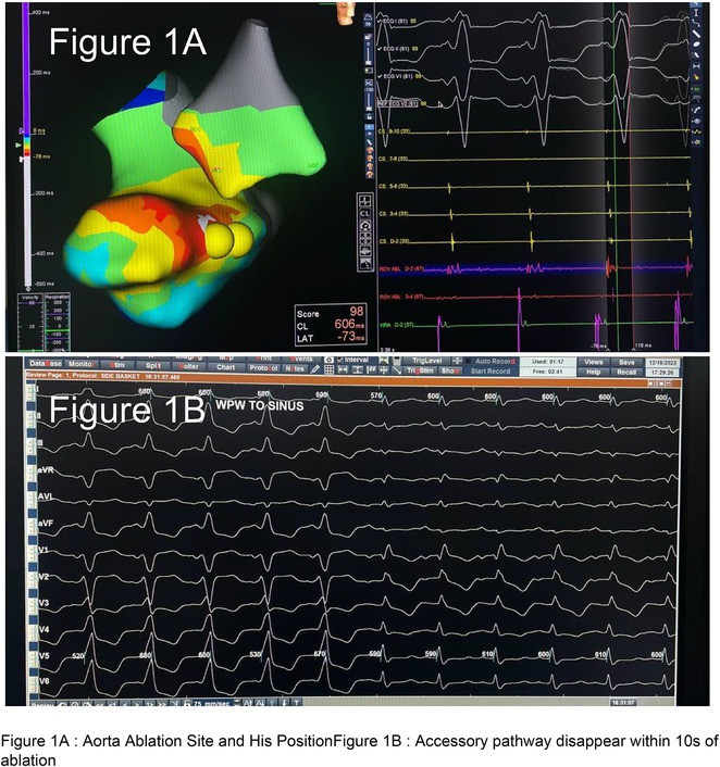 Figure 19