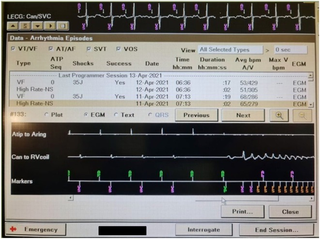 Figure 21