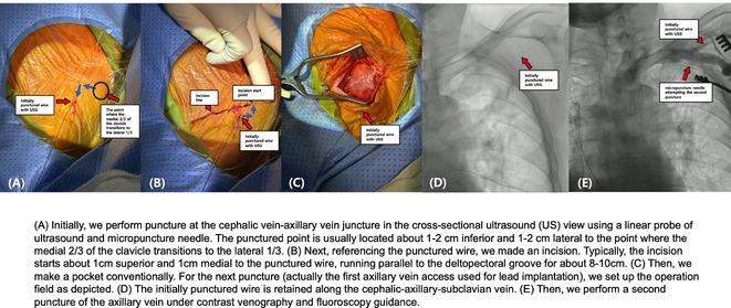 Figure 23