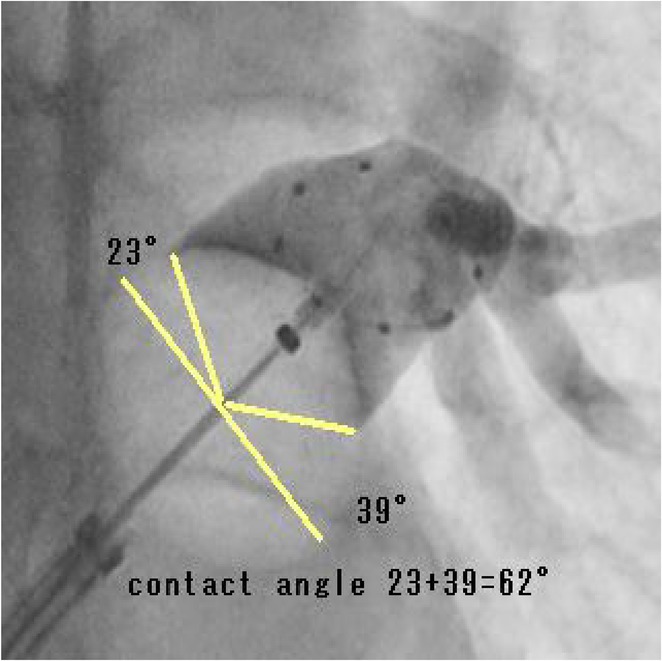 Figure 26