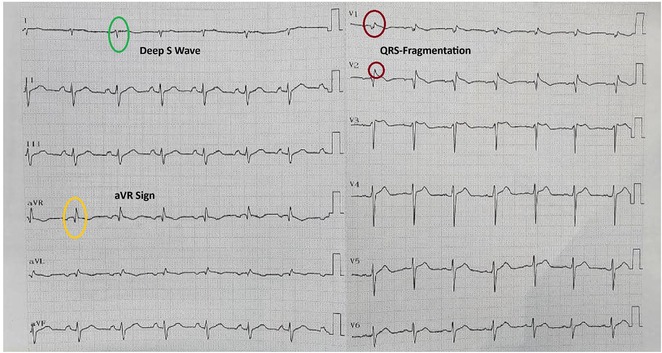 Figure 30